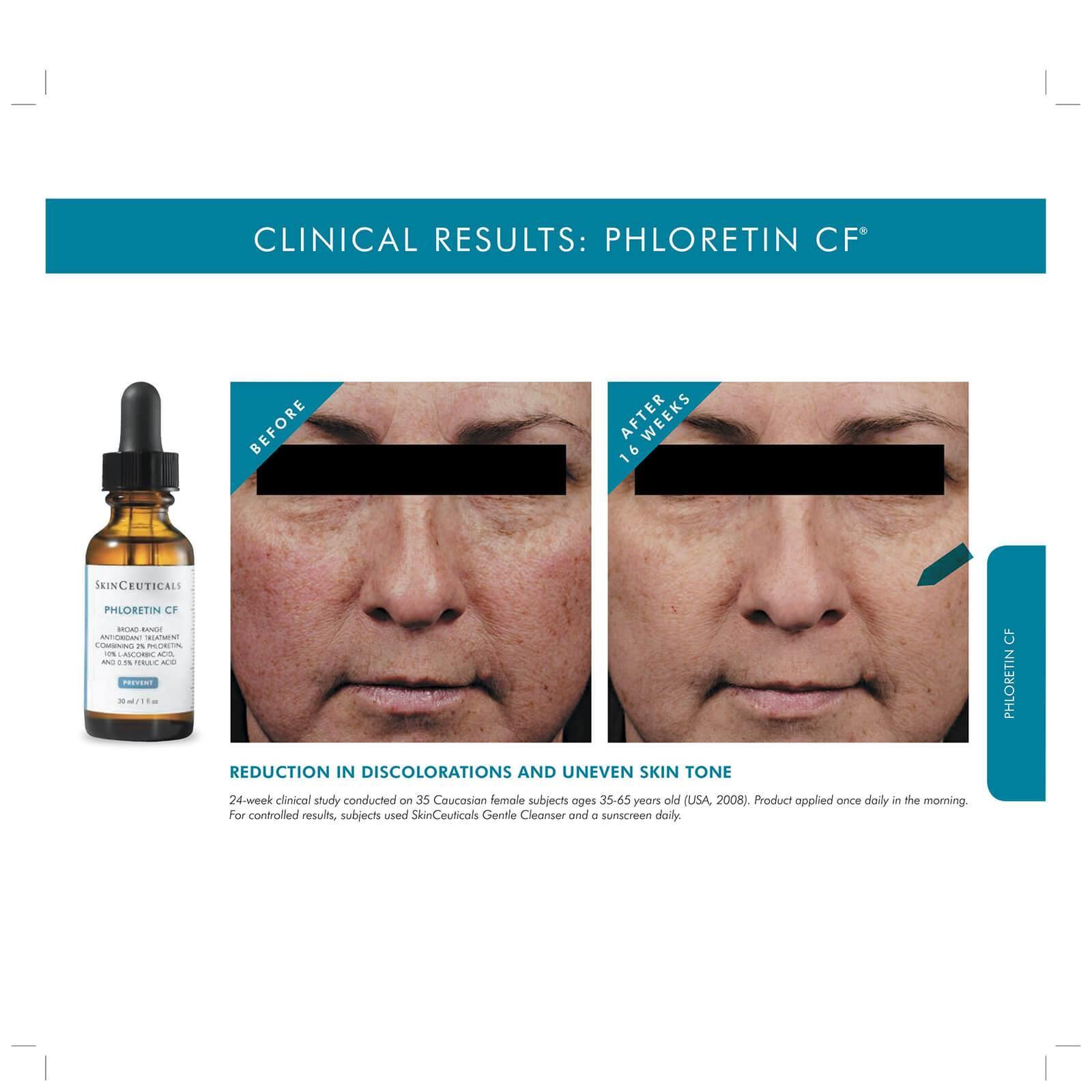 SkinCeuticals - Phloretin CF Serum (30ml) - British Aesthetics