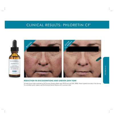 SkinCeuticals - Phloretin CF Serum (30ml) - British Aesthetics